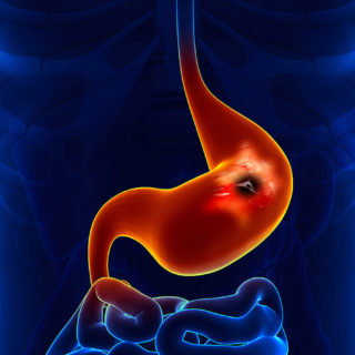 Houston Cancer Treatment Centers