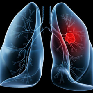 Houston Cancer Treatment Centers