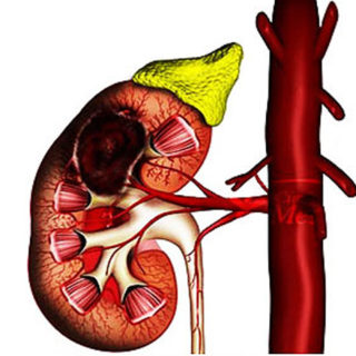 Houston Cancer Treatment Centers