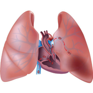 Houston Cancer Treatment Centers