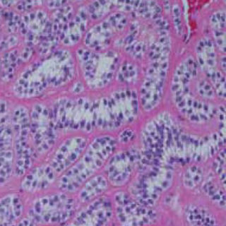 Houston Cancer Treatment Centers