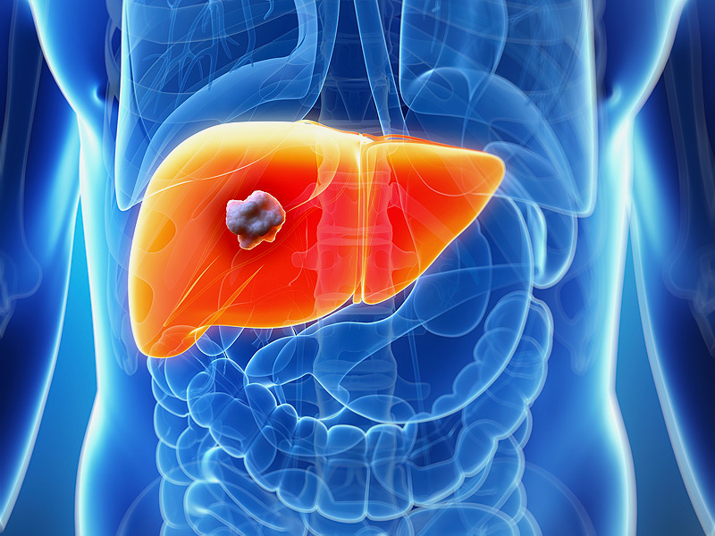 dt_150326_liver_cancer_800x600.jpg